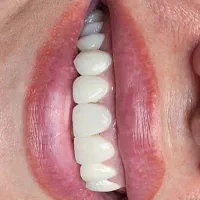 دستیار دندانپزشک