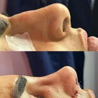 بهترین  عملهای صورت در بیمارستان
