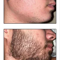 تغییر چشم‌گیر در ظاهر صورت (ضمانت کیفیت)