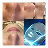 فیشیال و پاکسازی تخصصی