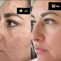 پادشاه کرم ها