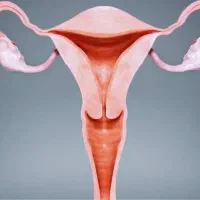 جراحی لابیا توسط جراح زنان اقساط