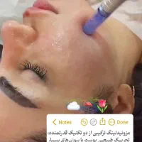 جشنواره الکترولیز موی سفیدصورت وگردن،لیزر،فیلر،مزو