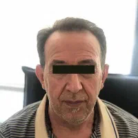 زیبایی صورت خود را احیا کنید