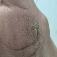 برای همیشه راحت شو