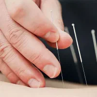 مرکز تخصصی طب سوزنی یافت آباد بلوار الغدیر