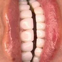آموزش دندانپزشکی مبحث،درمانی