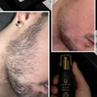 ریش پر پشت چهرتو می‌سازه