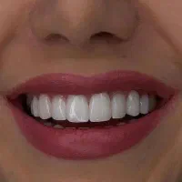 دندانپزشکی و دندان سازی خیریه چمران (جراحی. زیبایی|خدمات آرایشگری و زیبایی|تهران, امام حسین|دیوار