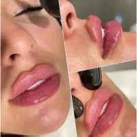 نیازمند مدل جهت فیلر(ژل)صورت و شقیقه و لب و زیرچشم