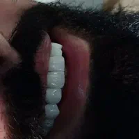 دندانپزشکی  به قیمت پارسال