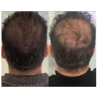 مثل کود برای ریش و مو عمل میکنه
