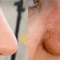 خدمات پلاسما