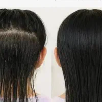 رهایی از رشک وشپش