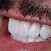 دندانپزشکی