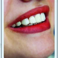 همکاری با دکتر دندانپزشک
