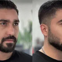 تزریق ژل فیلر بوتاکس کانتورینگ مردانه مزو ژل بادی