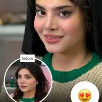 جشنواره تزریق ژل وبوتاکس بدون دردوکبودی