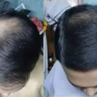 از جمع کچلا در بیا