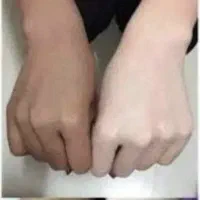 آموزش حرفه ای و تخصصی سفید کردن پوست