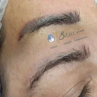 ریموو تخصصی تتوی صورت
