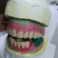 دندانسازی دندان مصنوعی و پلاک ارتودنسی