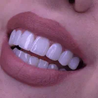 لمینت و کامپوزیت