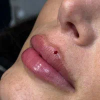 خدمات پیرسینگ تزریق ژل و بوتاکس خانم ها و آقایون