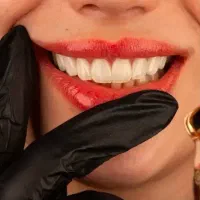 زیبایی لبخند شما