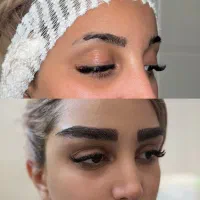 تخفیف ویژه میکروکاشت ابرو نقد و اقساط