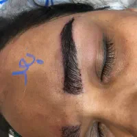 کاشت ابرو بدون جراحی  و بدون دوره ی نقاهت