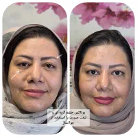 جشنواره تابستانی خدمات زیبایی در مطب توسط پزشک