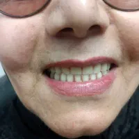 لابراتور دندانسازی