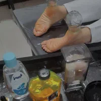 پدیکور درمانی و بادکش درمانی برای بانوان