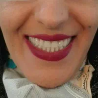 دندان مصنوعی،دندان،دندانسازی،پنجاه درصدتخفیف ویژه