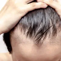 راهنمایی کنید برای جلوگیری ازریزش مو