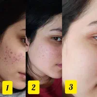 حراج ویژه محصولات پوستی لدورا