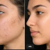 درخشش تو از مراقبت از خودت شروع میشه
