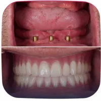 دندانپزشکی شبانه روزی زهره صادقیه غرب تهران