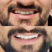کلیه خدمات دندانپزشکی همراه با ضمانت نامه کتبی