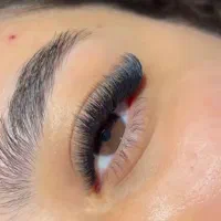 کاشت مژه
