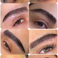 مدل کاشت ۹،۹۰۰ بدون جراحی توسط استاد جمعه