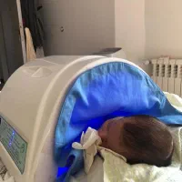 اجاره دستگاه زردی نوزاد(فتوتراپی درمنزل)