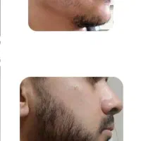 با من تو کمتر از 20 روز ریش دار شو