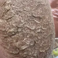 پدیکور|خدمات زیبایی و سلامت|مهاباد (آذربایجان غربی), |دیوار