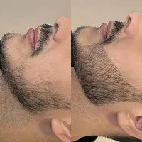 بمب پرپشتی