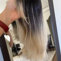 کلاهگیس فرق پوستی