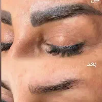 لیزر تاتو کیوسوییچ ۲۰۲۴ و کربن