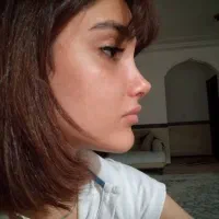 جراحی بینی ویژه مراجعین از ابهر/در تهران/۴۳میلیون