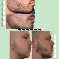 ریشت کم پشته  یه راهکار هست